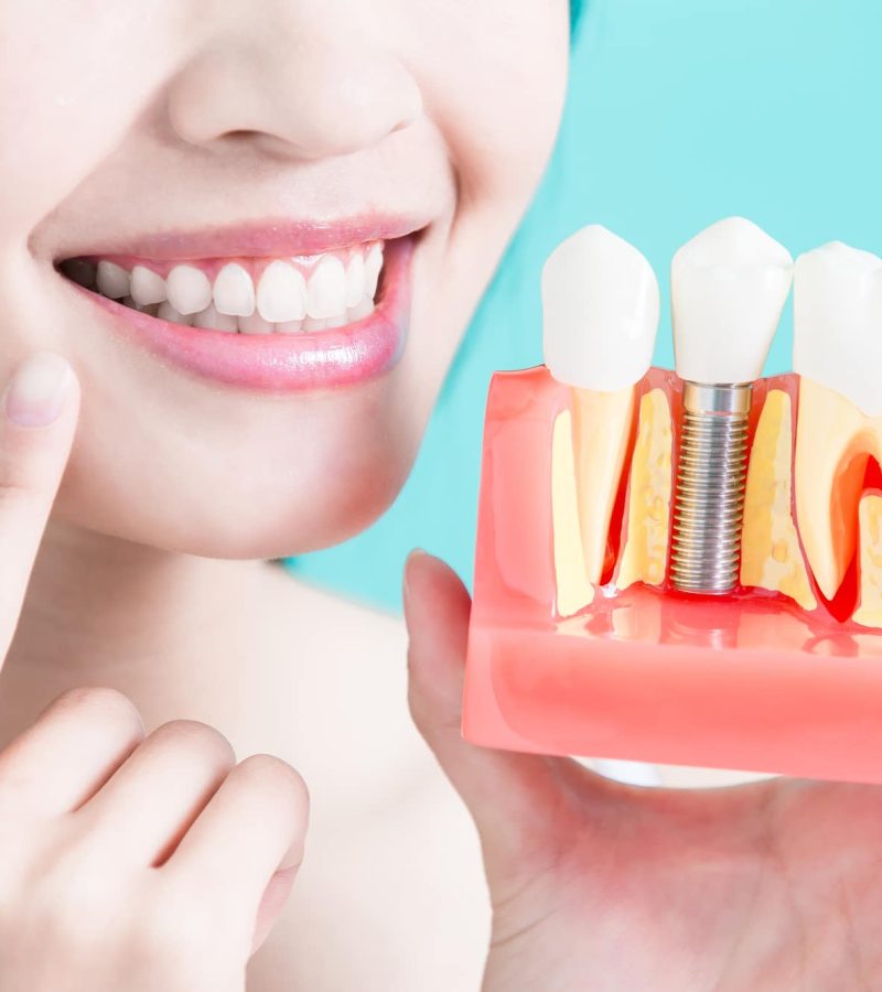 TITAN Health Awards Winner - Koster Denture Clinic - Canadian Denturist Website Redesign 2
