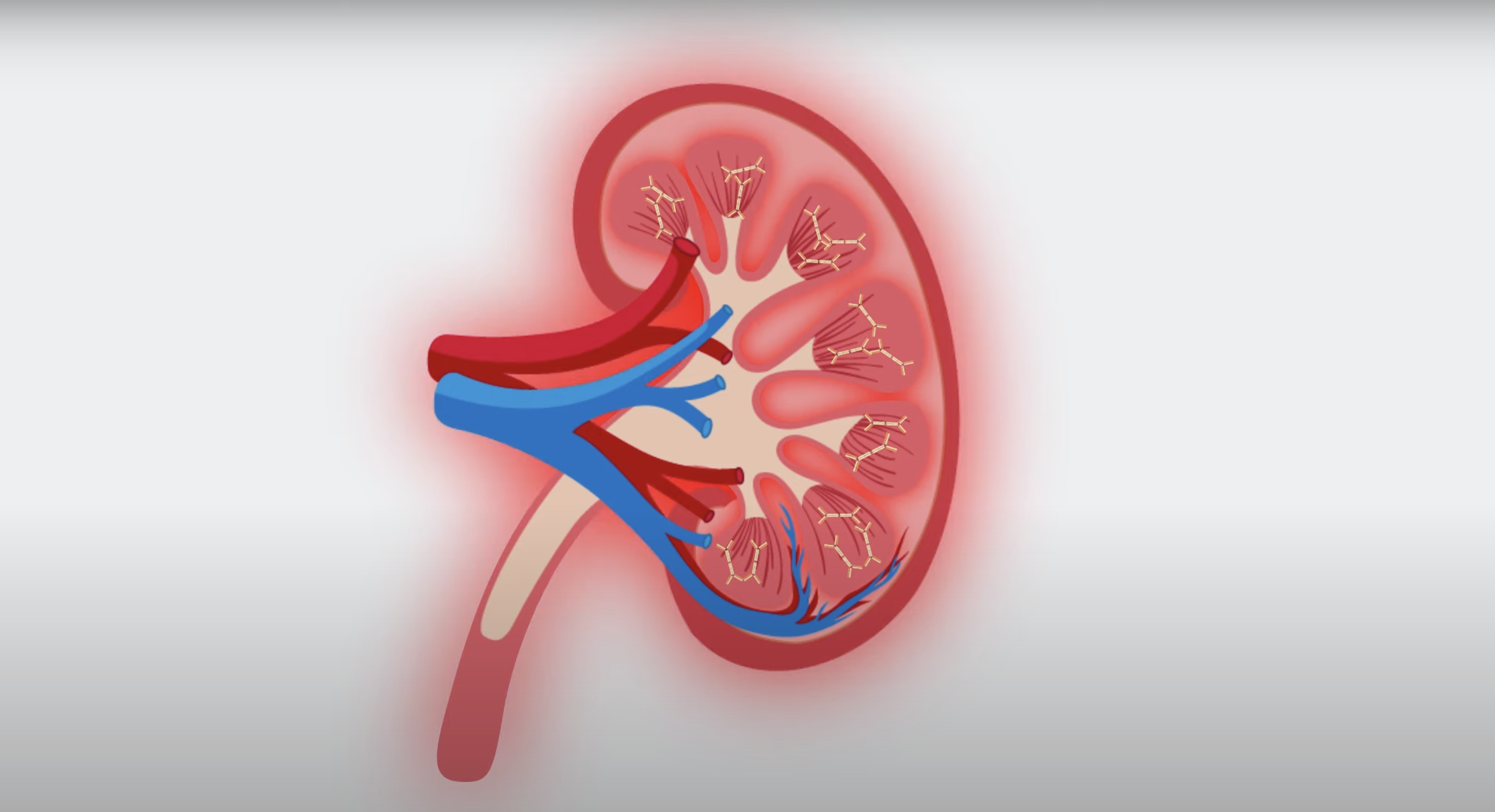 TITAN Health Awards Winner - What is IgA nephropathy (IgAN)? | Rare Kidney Disease 1