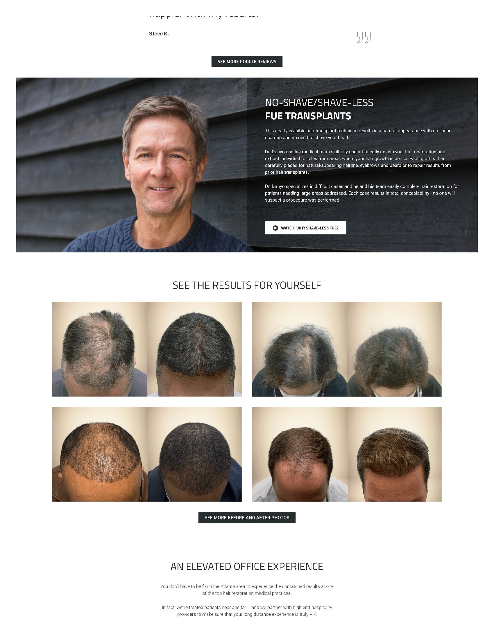 TITAN Health Awards Winner - Hair Restoration Website 6