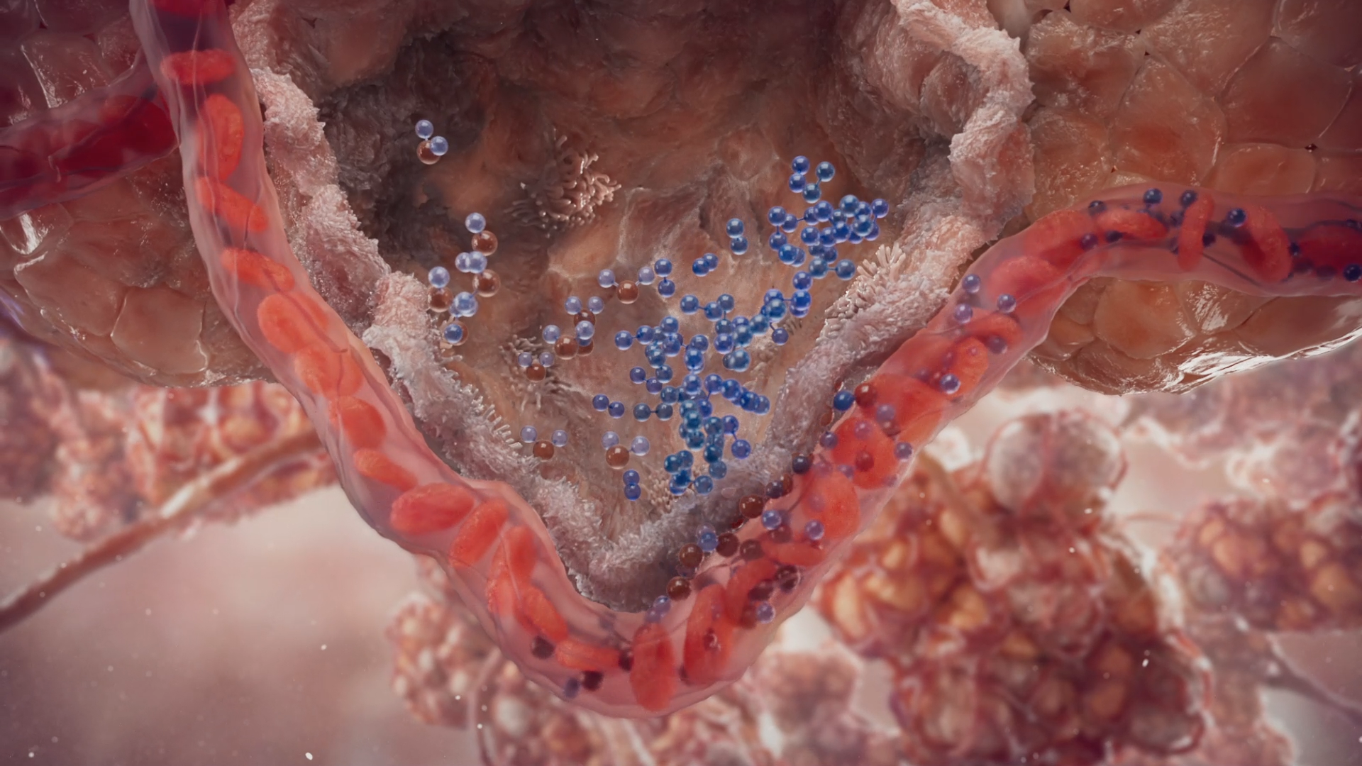 TITAN Health Awards Winner - Vantive ECCO2R Mechanism of Action 8