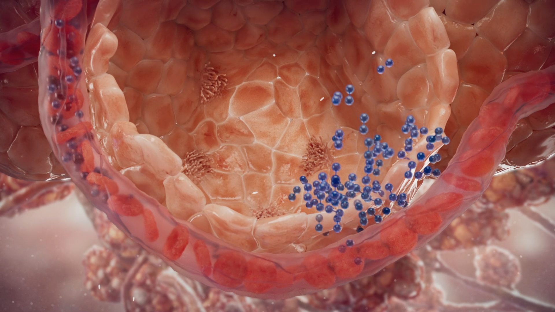 TITAN Health Awards Winner - Vantive ECCO2R Mechanism of Action 7