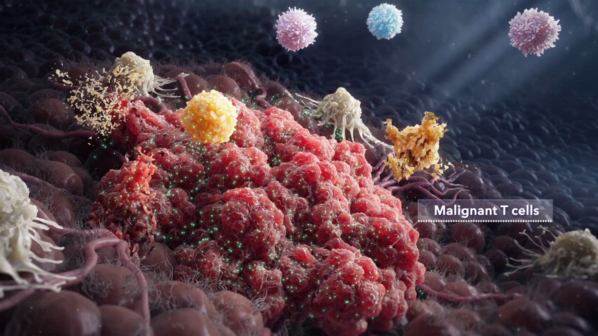 TITAN Health Awards Winner - Targeting CTCL with Precision - The Power of IL2 Receptor Therapy 2