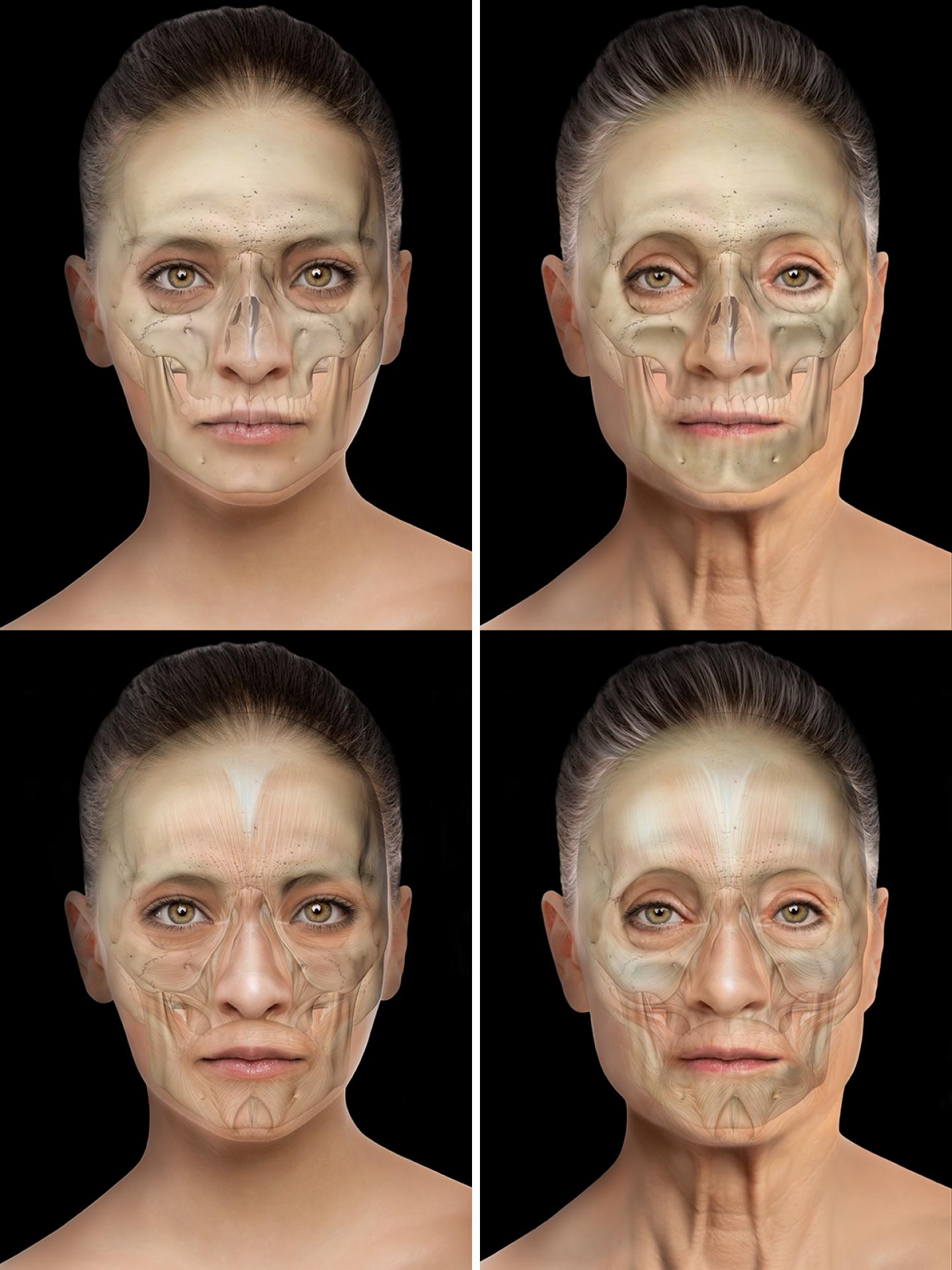 TITAN Health Awards Winner - Evolus Academy Aesthetics Education on Facial Anatomy 2