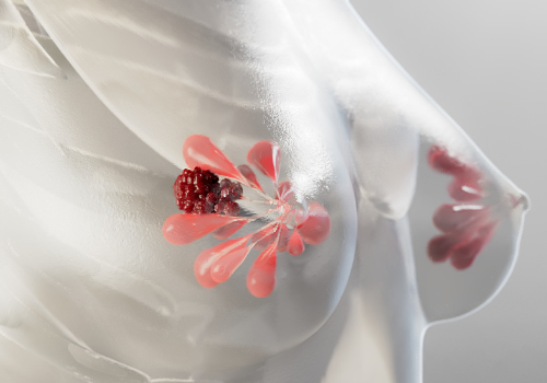 TITAN Health Awards Winner -  Breast Cancer Treatment | Virtual Reality Experience By Random42 Scientific Communication