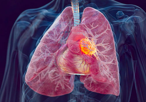 TITAN Health Awards Winner -  V940 Mechanism of Action  By iso-form