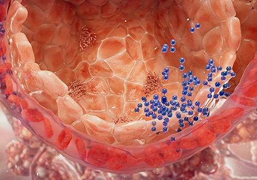 TITAN Health Awards Winner -  Vantive ECCO2R Mechanism of Action By Helix Animation