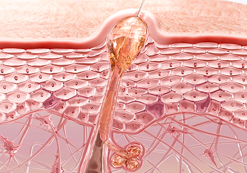 TITAN Health Awards Winner -  Etat Pur -  Acne Actives By Helix Animation