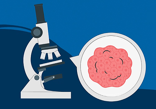 Know Your Kidneys: The Importance of Testing, Healthcare Awards Winner
